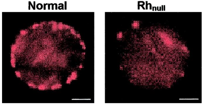 rhnull is the rarest blood group in the world