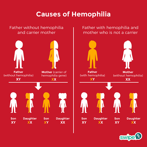 causes of hemophilia