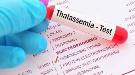 thalassemia test diagnosis hemoglobin electrophoresis