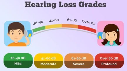 WHO hearing impairment grading