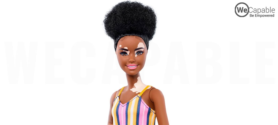 barbie with vitiligo