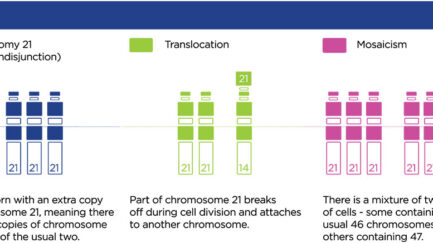 down syndrome illustration showing trisomy translocation and mosaicism