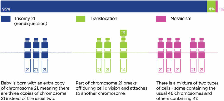 Down Syndrome: Types, Causes, Symptoms and Treatment