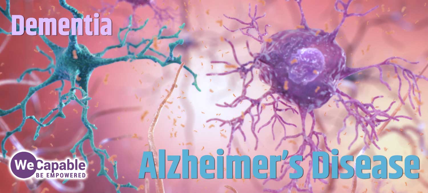 image showing neurons with overlay of words alzheimers disease and dementia.