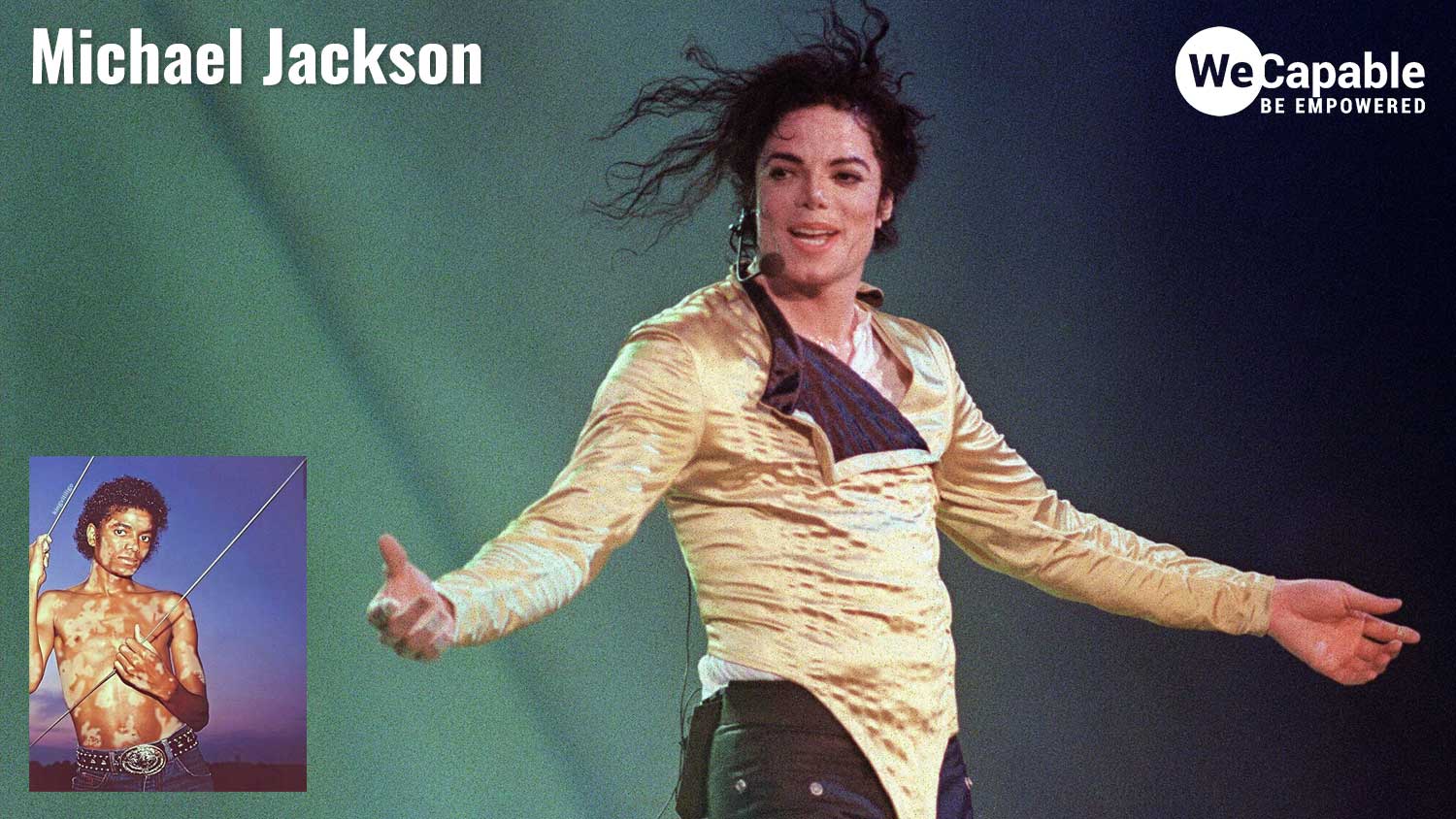 Photograph of michael jackson dancing and inset photo of MJ with vitiligo condition