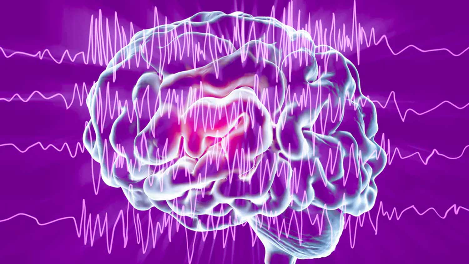 illustration for chronic neurological disorders