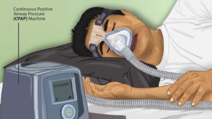 illustration showing a person using cpap machine for treatment of sleep apnea.